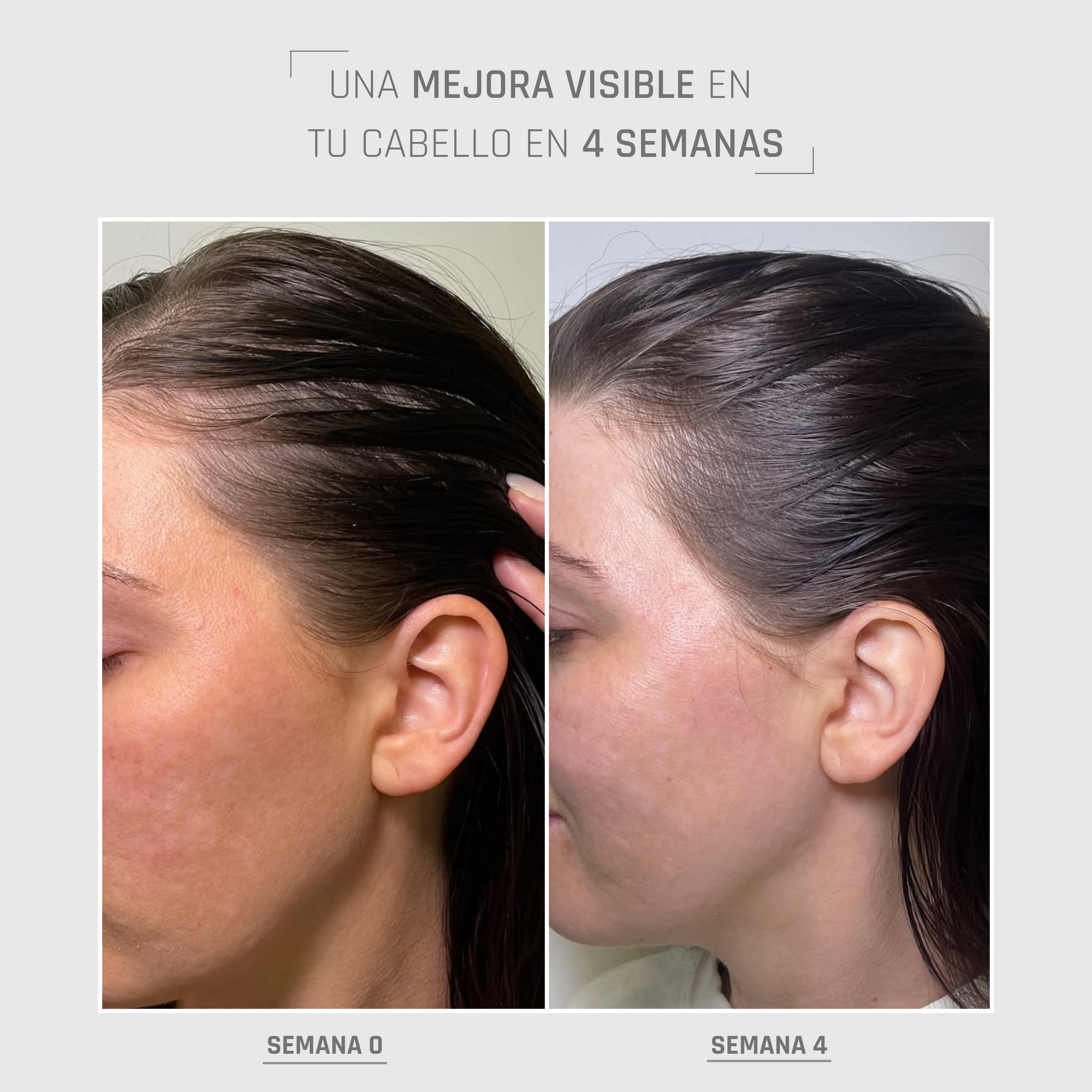 HairBOOST Serum Spray | Densidad y fortaleza capilar