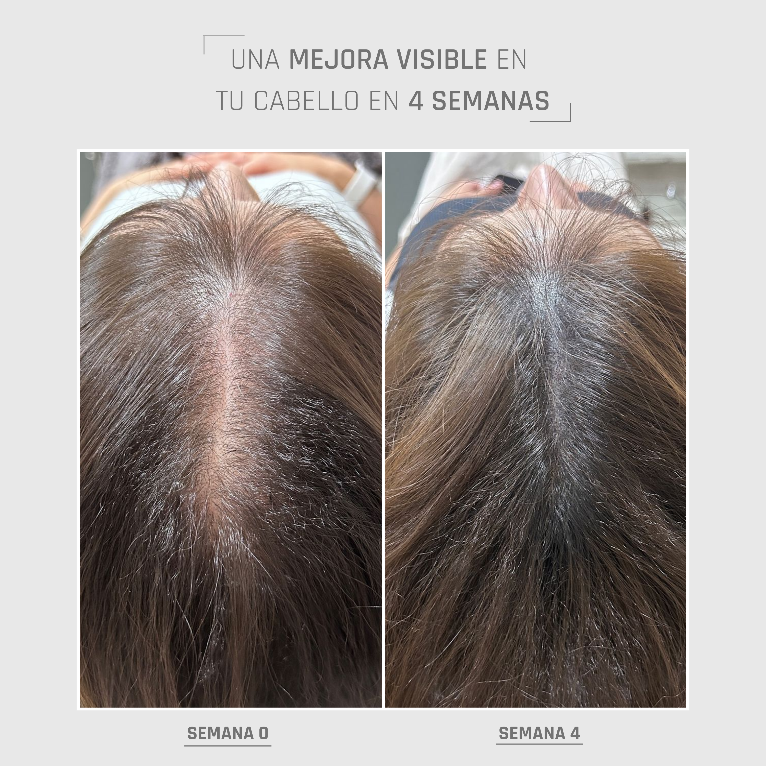 HairBOOST Serum Spray | Densidad y fortaleza capilar