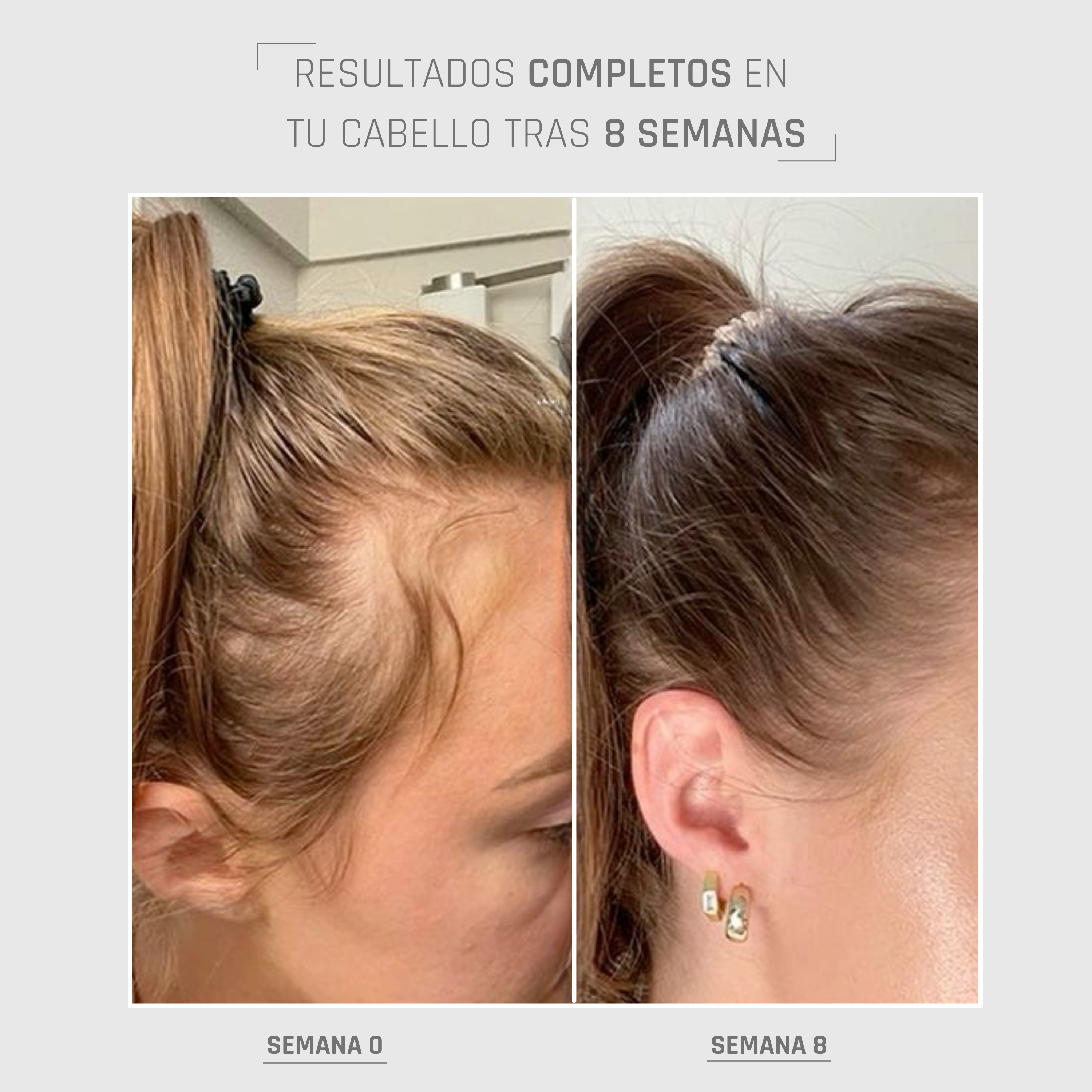 HairBOOST Serum Spray | Densidad y fortaleza capilar