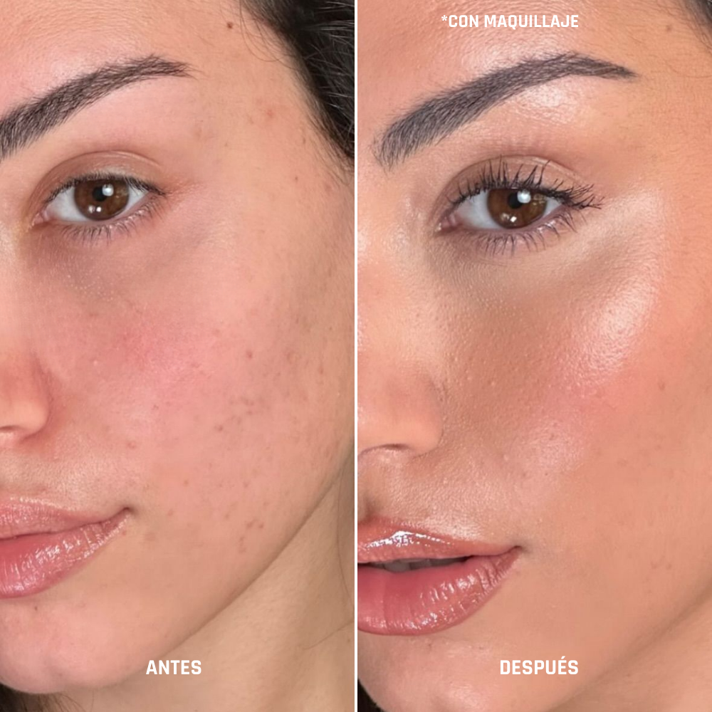 Solarea Protect | Spray fijador con SPF 50