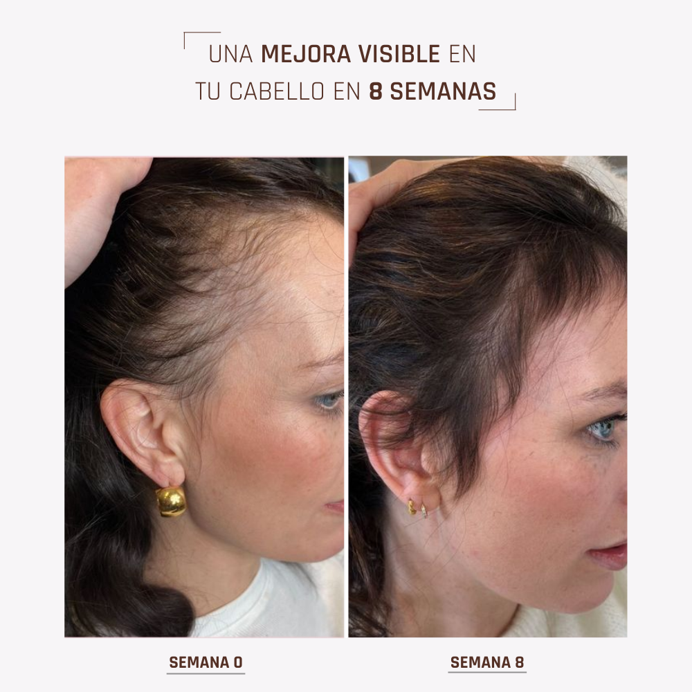 HairBOOST Serum spray | Crecimiento acelerado y brillo intenso