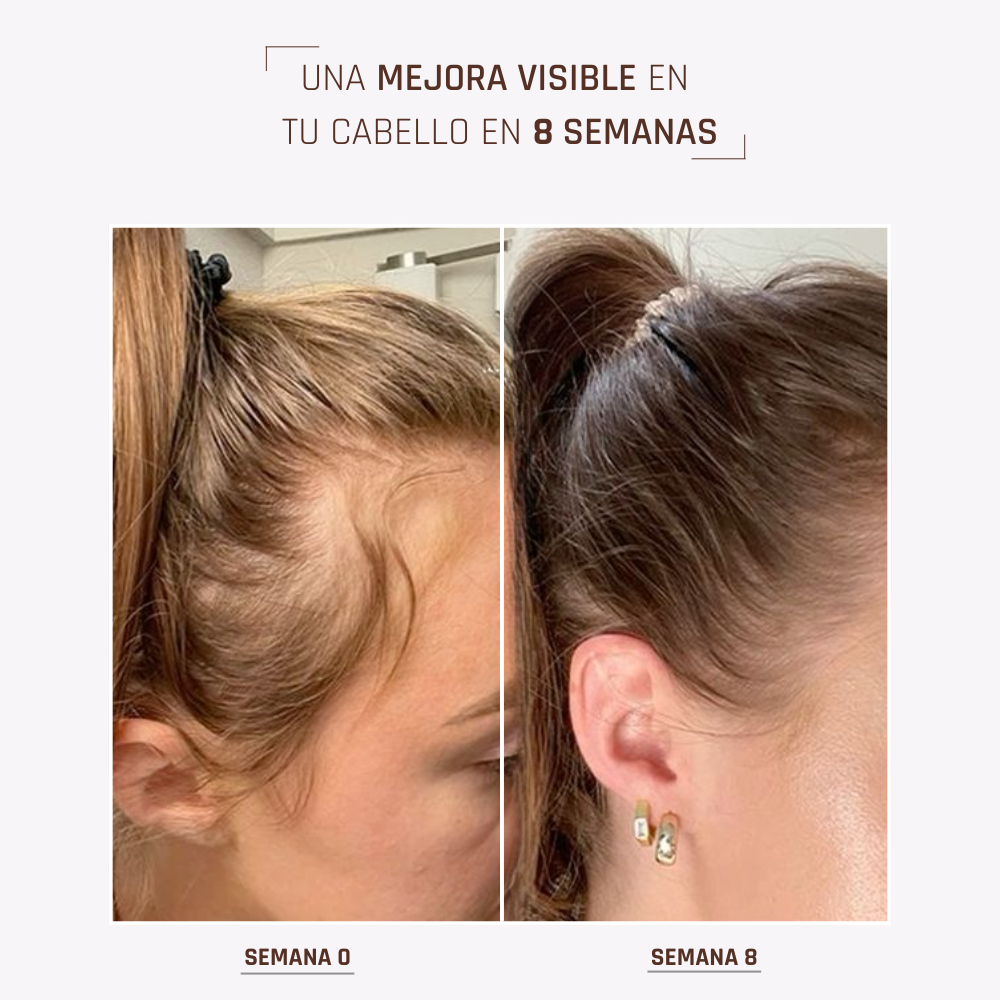 HairBOOST Serum spray | Crecimiento acelerado y brillo intenso