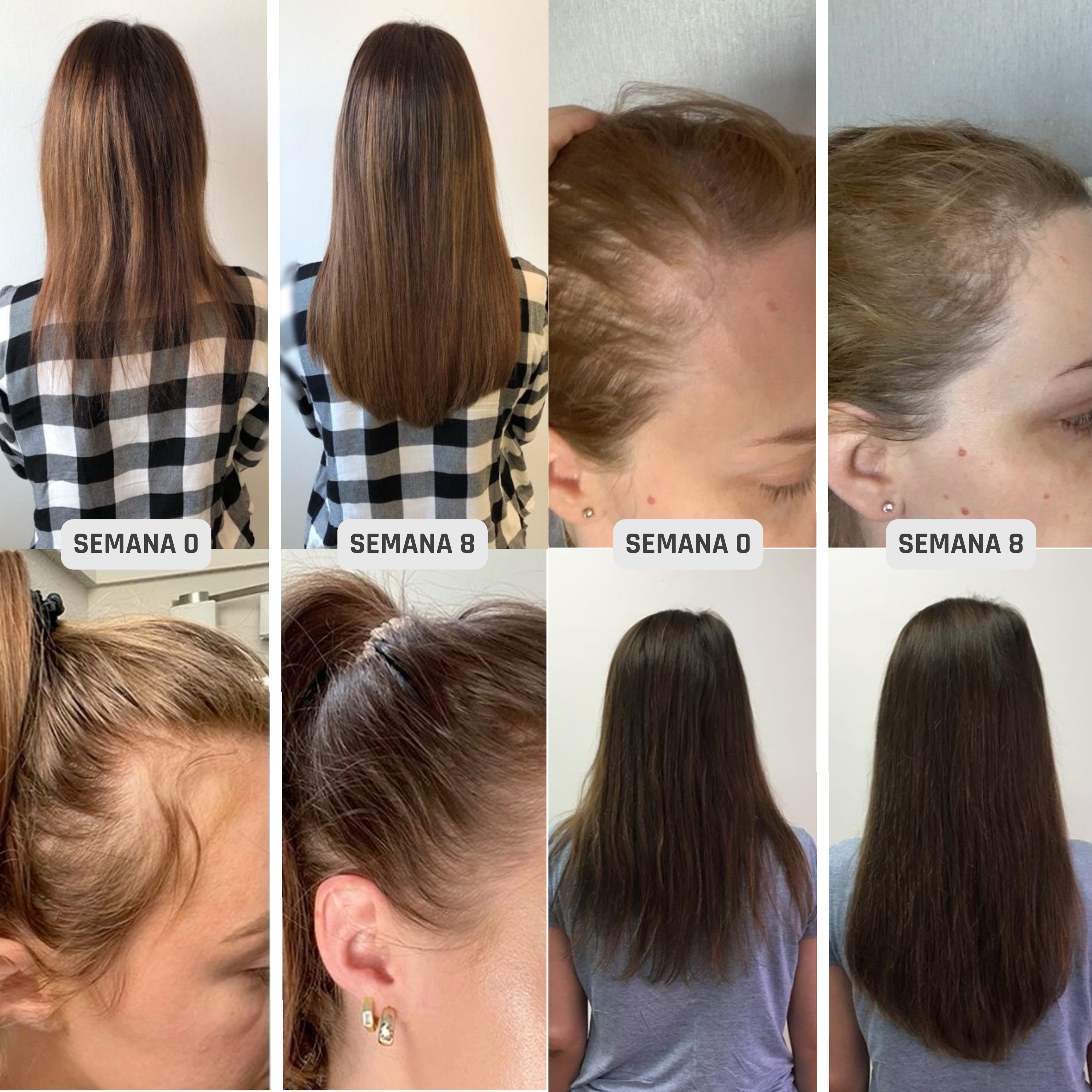 HairBOOST Serum Spray | Densidad y crecimiento visible en 4 semanas