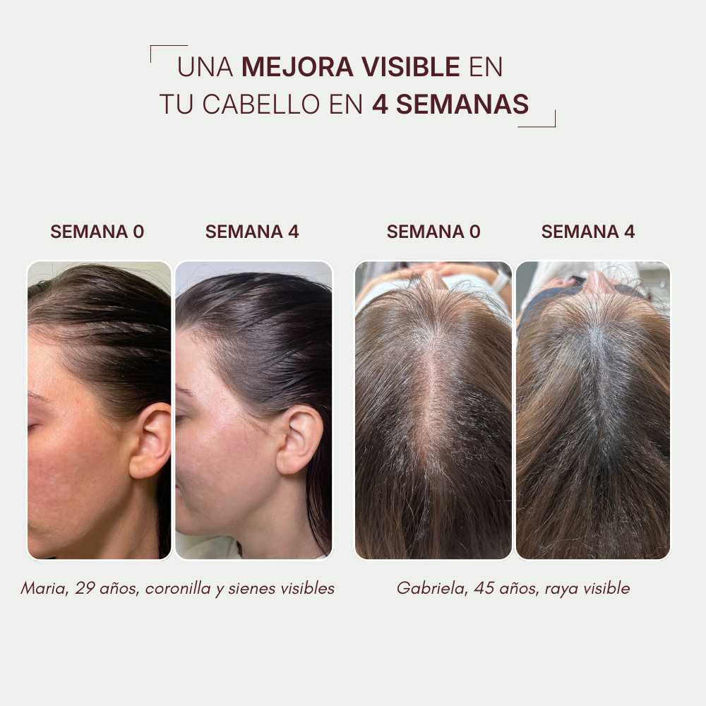 HairBOOST Sérum capilar | Tratamiento anticaída y crecimiento capilar