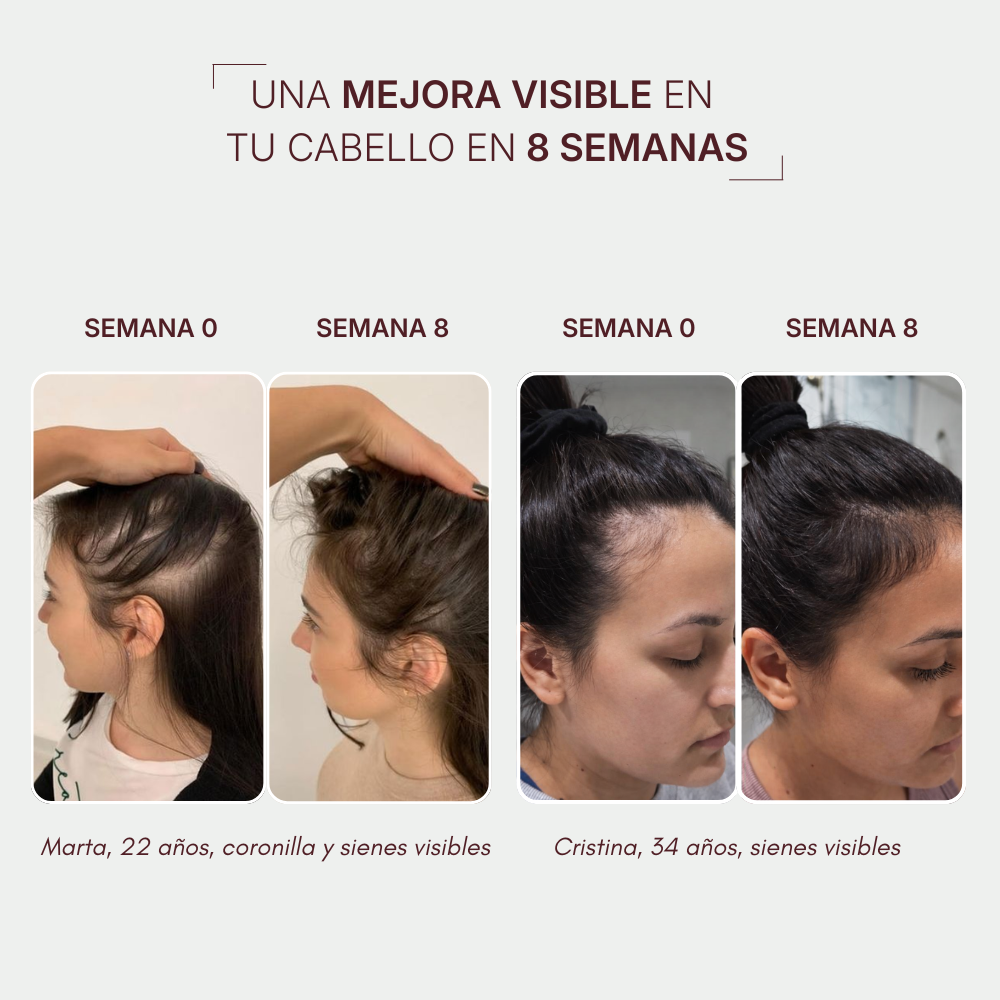 HairBOOST Sérum capilar | Tratamiento anticaída y crecimiento capilar