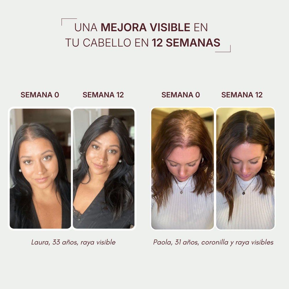 HairBOOST Sérum capilar | Tratamiento anticaída y crecimiento capilar